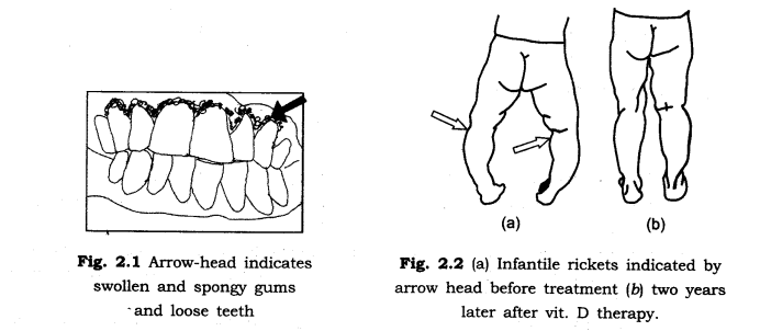 NCERT Solutions Class 6 Science Components of food