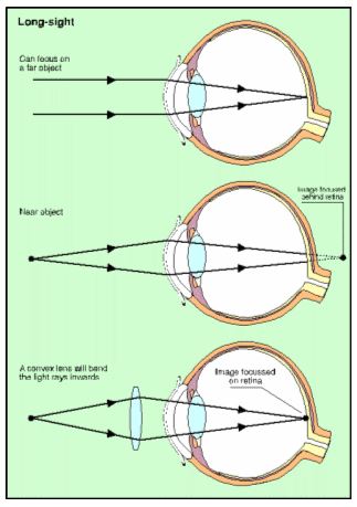 NCERT Solutions Class 10 Science Human Eye and Colourful World